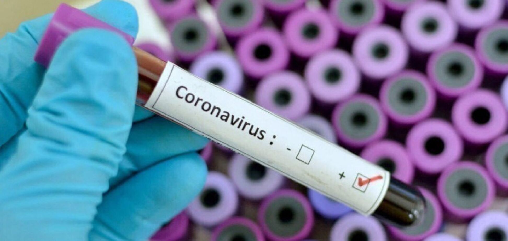На Дніпропетровщині зафіксували ще один випадок коронавірусу