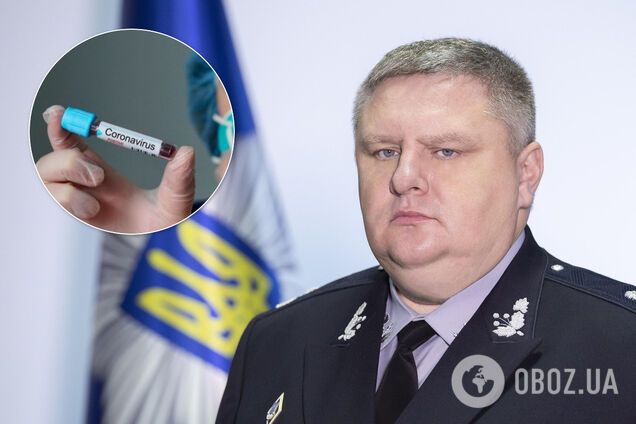 У начальника полиции Киева обнаружили коронавирус: больные еще двое правоохранителей и курсант
