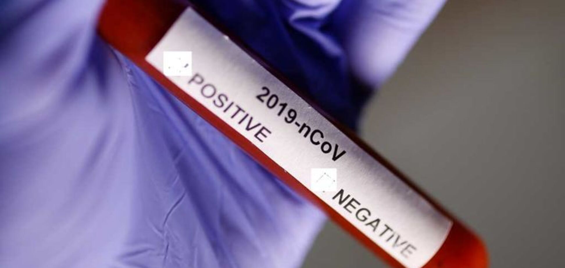 В Украине такие же? Испания вернула Китаю бракованные тесты на коронавирус