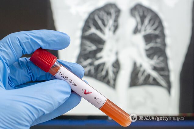 Как в Италии и Испании: в Украине врачам хотят позволить лечить от коронавируса новыми лекарствами