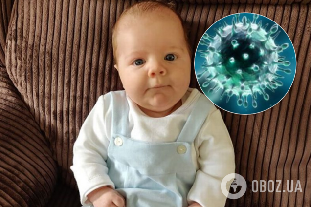 Мать назвала симптомы коронавируса у младенца – под ударом кожа и глаза