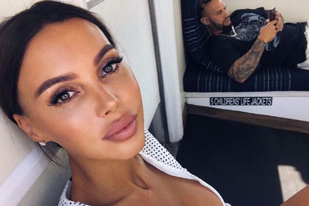 Как Оксана Самойлова изменилась после пластики