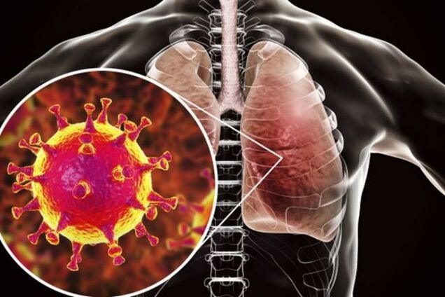 Коронавирус