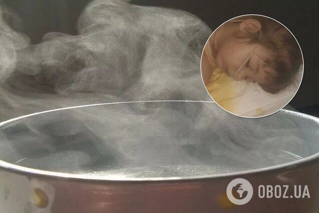 Стало відомо про стан ошпареної окропом дитини з Дніпра