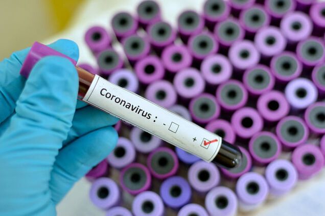 В Украине экстренно госпитализировали женщину с подозрением на коронавирус