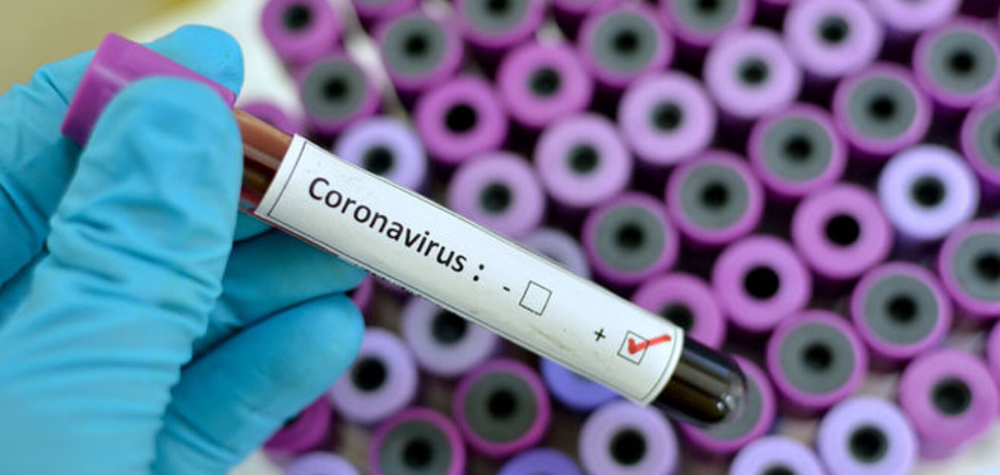 В Украине экстренно госпитализировали женщину с подозрением на коронавирус