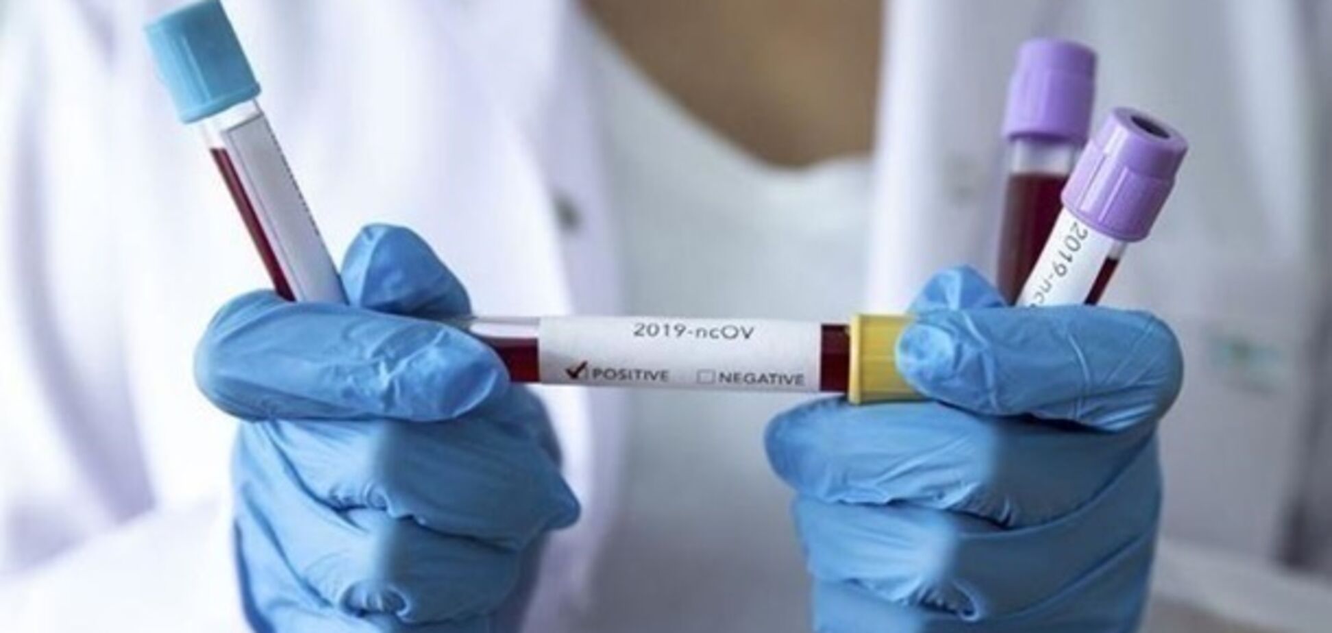 Врачи объяснили, почему коронавирус реже убивает женщин и детей