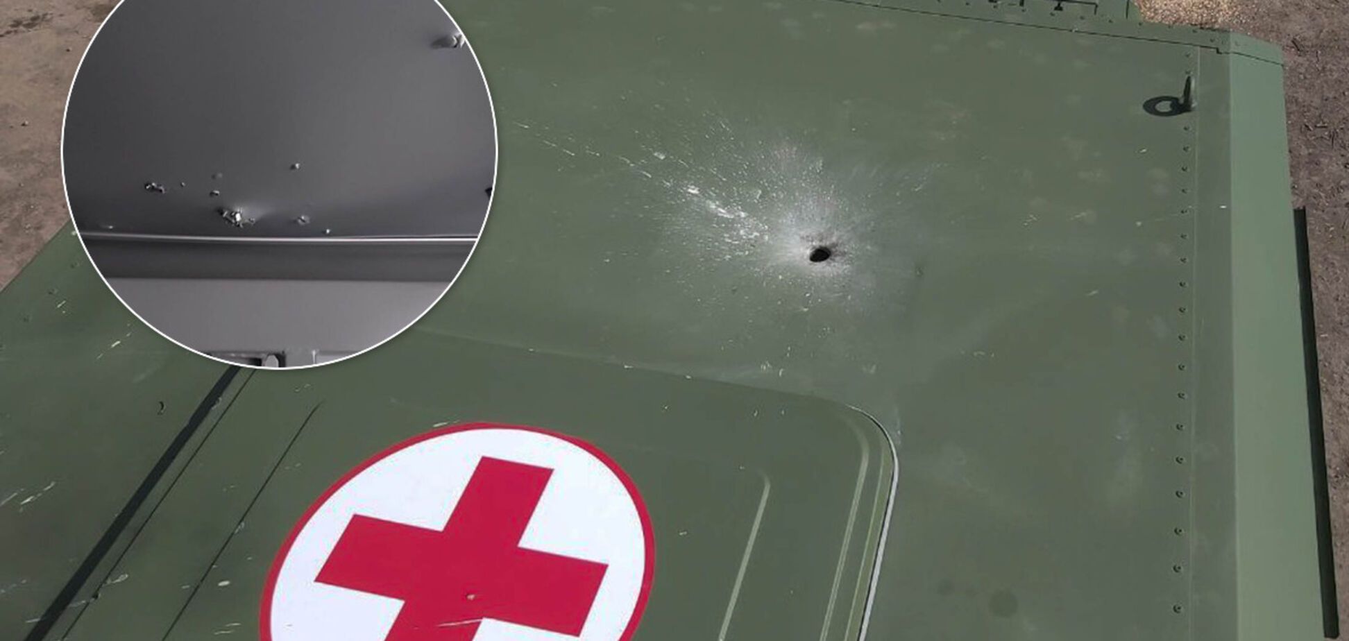 Найманці Путіна скинули дві гранати на санітарний автомобіль воїнів ООС. Фото