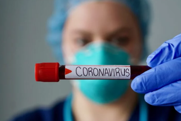 Кількість хворих на коронавірус в Україні зросла до 669: статистика МОЗ на 1 квітня