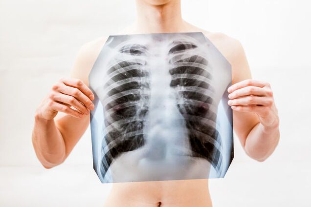Як перевірити роботу легень вдома: лікар дав просту інструкцію