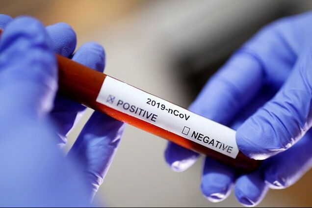 На Рівненщині у чотирьох пацієнтів повторно знайшли коронавірус