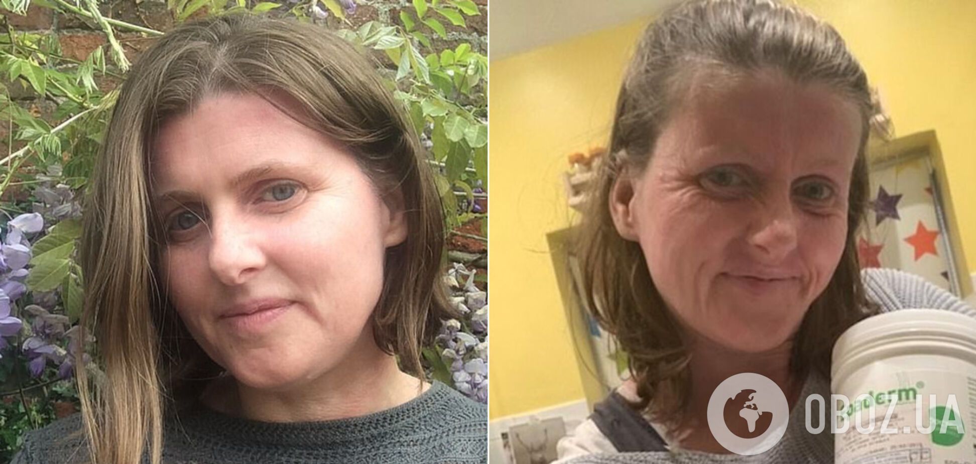 Жінка спеціально постаріла на 20 років за один