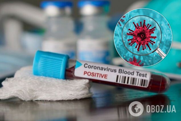 У крові хворих знайшли антитіла, що вбивають коронавірус
