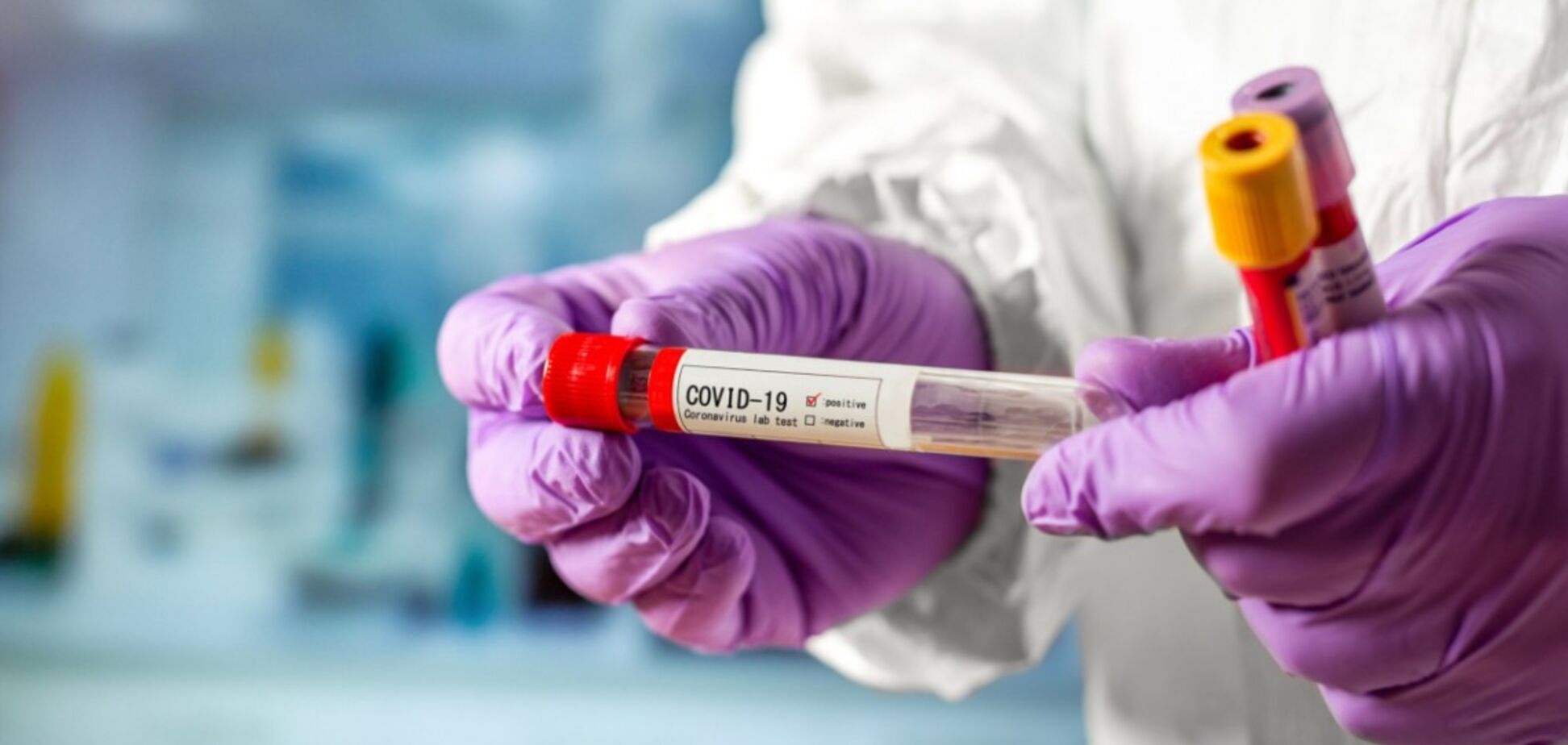 На Дніпропетровщині за добу знайшли ще 11 заражених коронавірусом