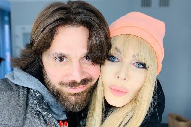 Білик розповіла про скандал з чоловіком-азербайджанцем через ревнощі