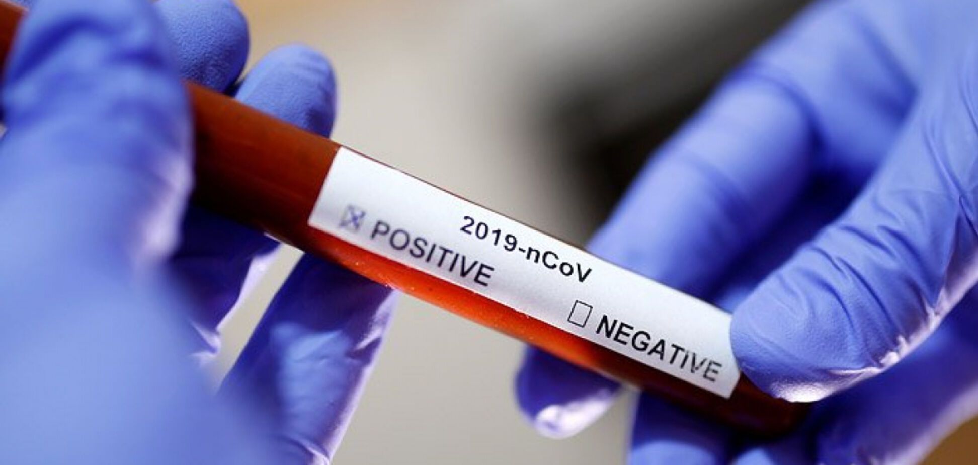 Пик коронавируса во многих странах пройден: эпидемиолог объяснила позитивную динамику