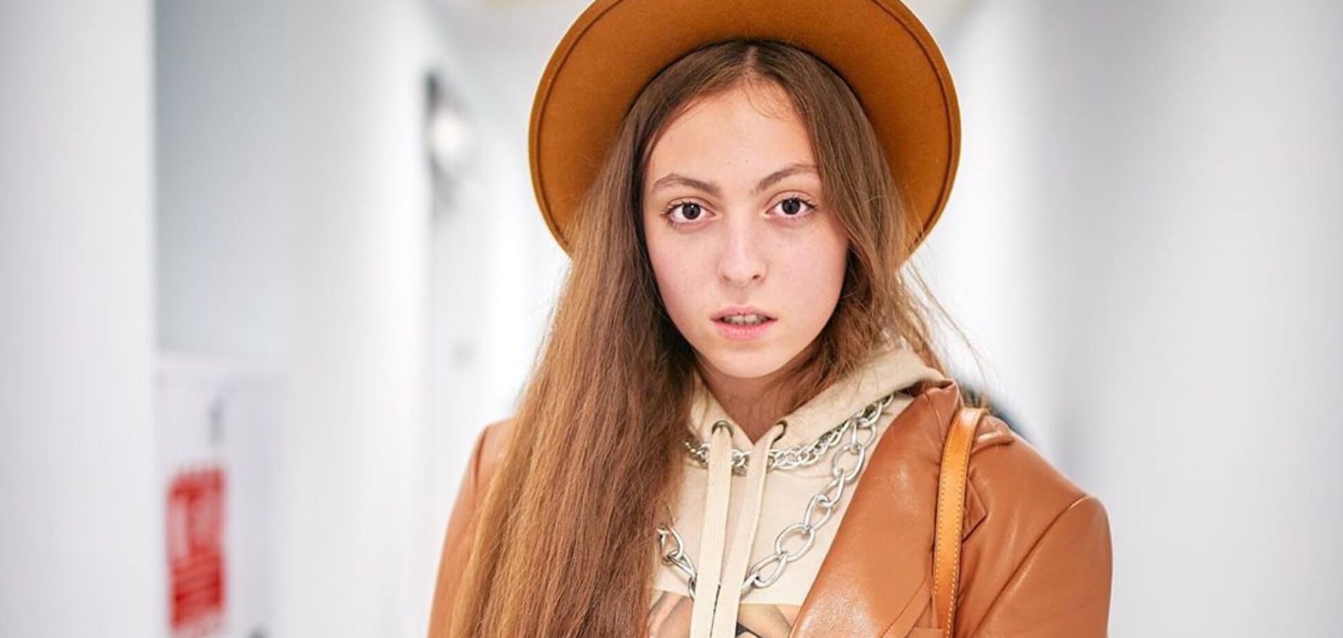 15-летняя дочь Поляковой показала побои на лице и разозлила сеть