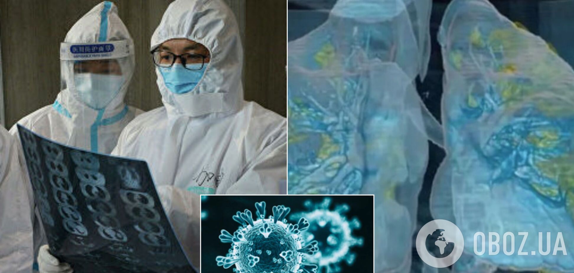 Виявлено приховану ознаку коронавірусу: не залишає легеням шансу