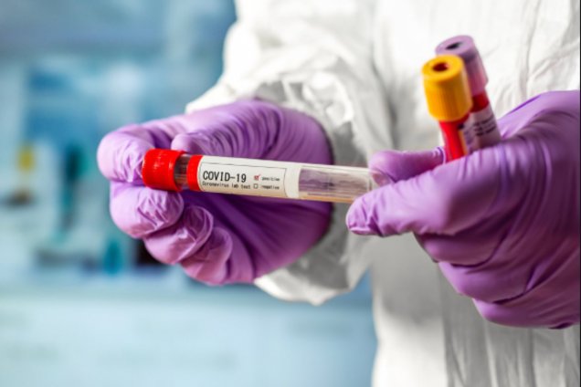 На Миколаївщині трапився груповий спалах COVID-19