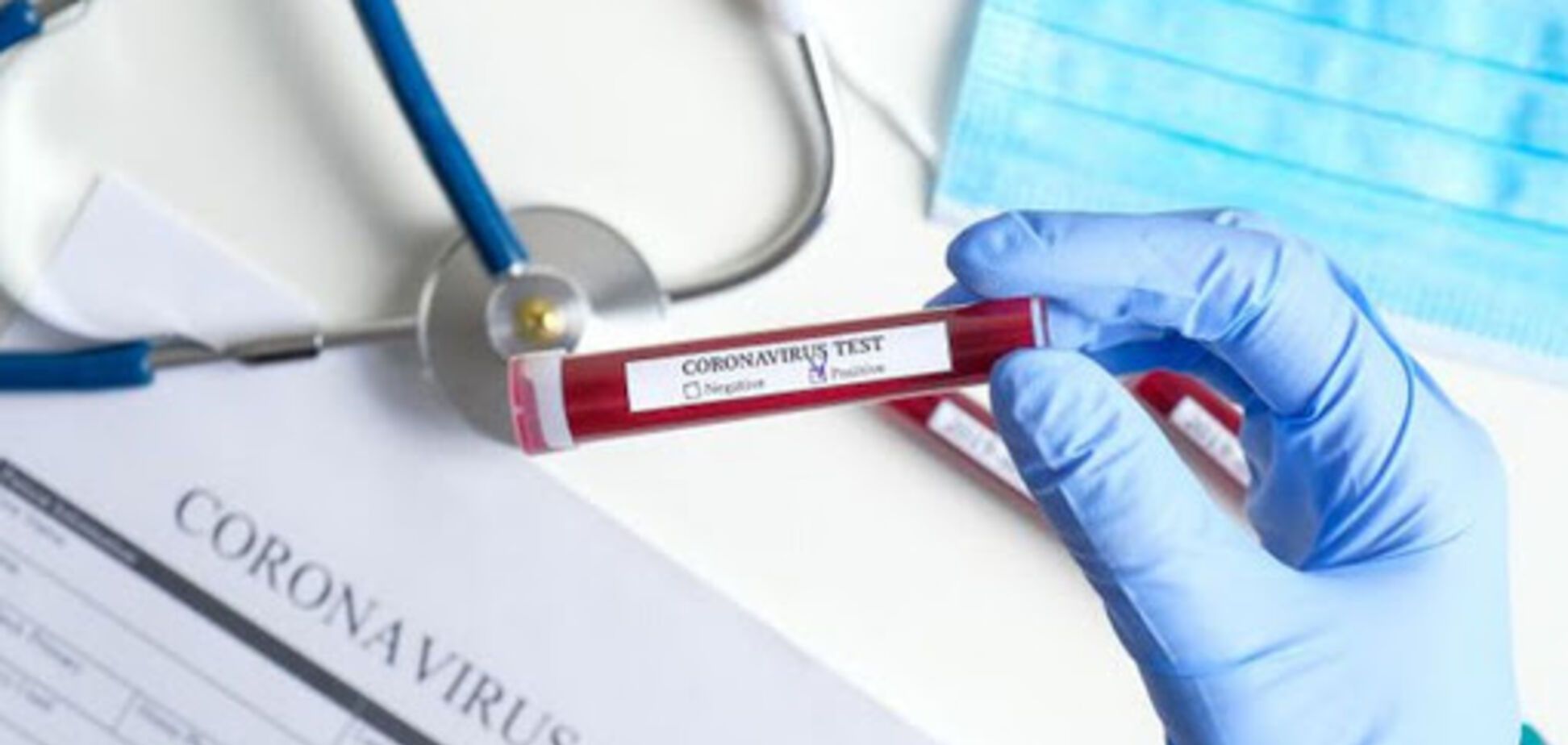 В Днепре увеличилось количество зараженных коронавирусом