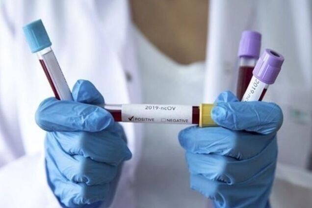 На Буковине за сутки добавилось почти 100 случаев коронавируса