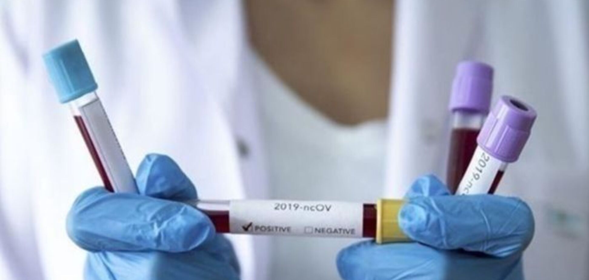 На Буковине за сутки добавилось почти 100 случаев коронавируса