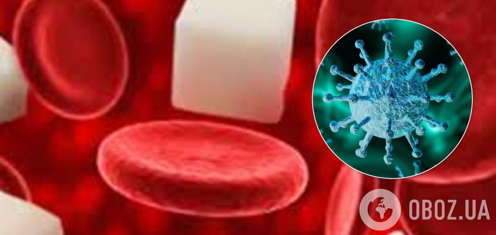 Вчені пояснили, чому діабет небезпечний під час коронавірусу