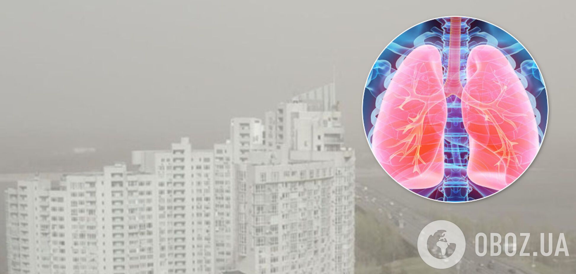 Набряки легень і алергія навіть у здорових: пульмонолог пояснила, чим небезпечне брудне повітря