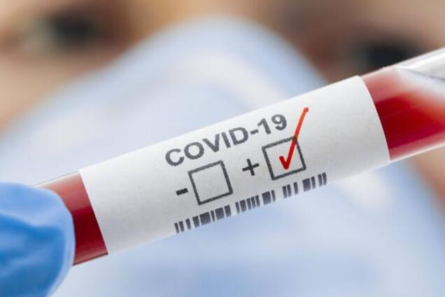 Количество случаев коронавируса в Украине выросло до 804: статистика Минздрава на 2 апреля