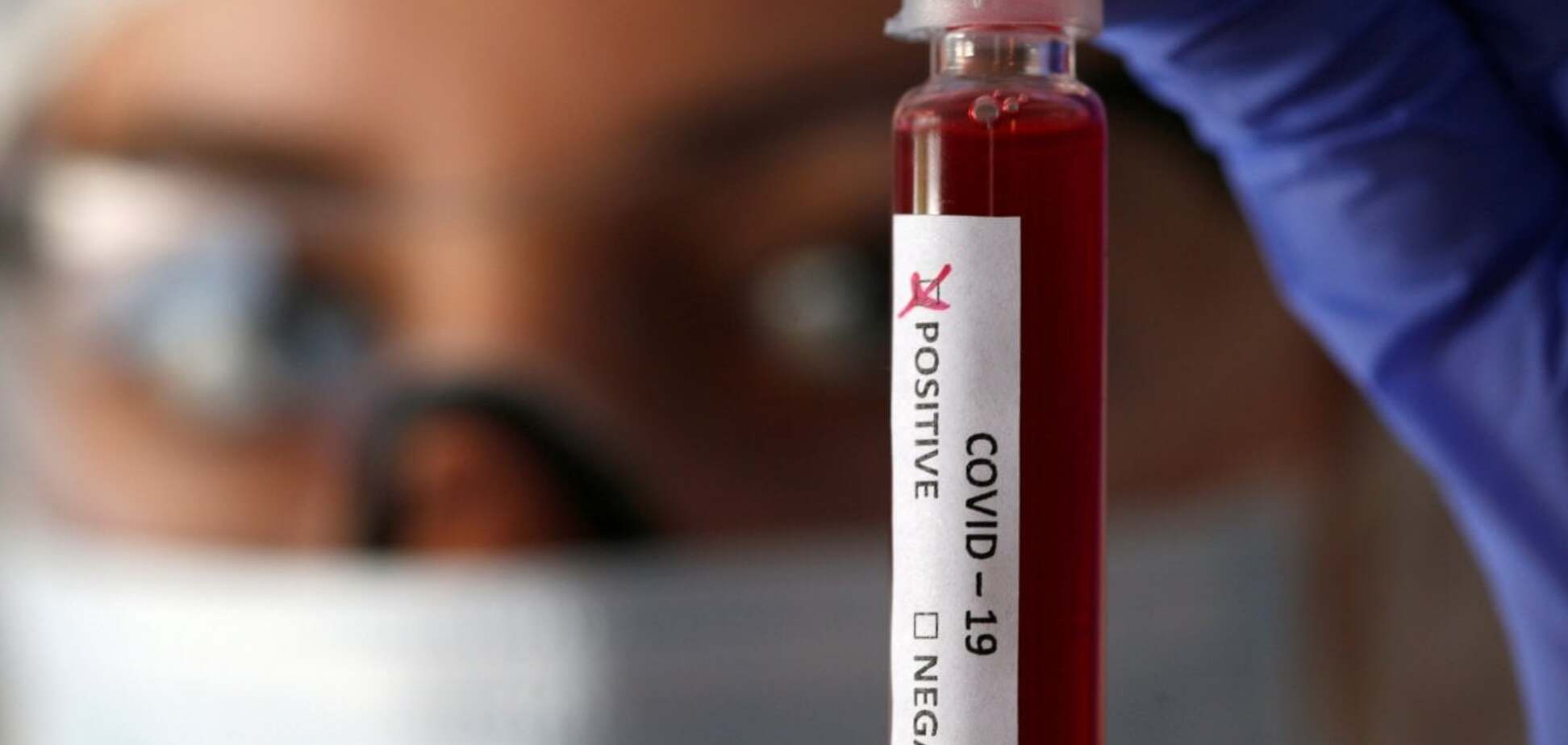 Коронавирус на Днепропетровщине: опубликована свежая статистика заболеваемости