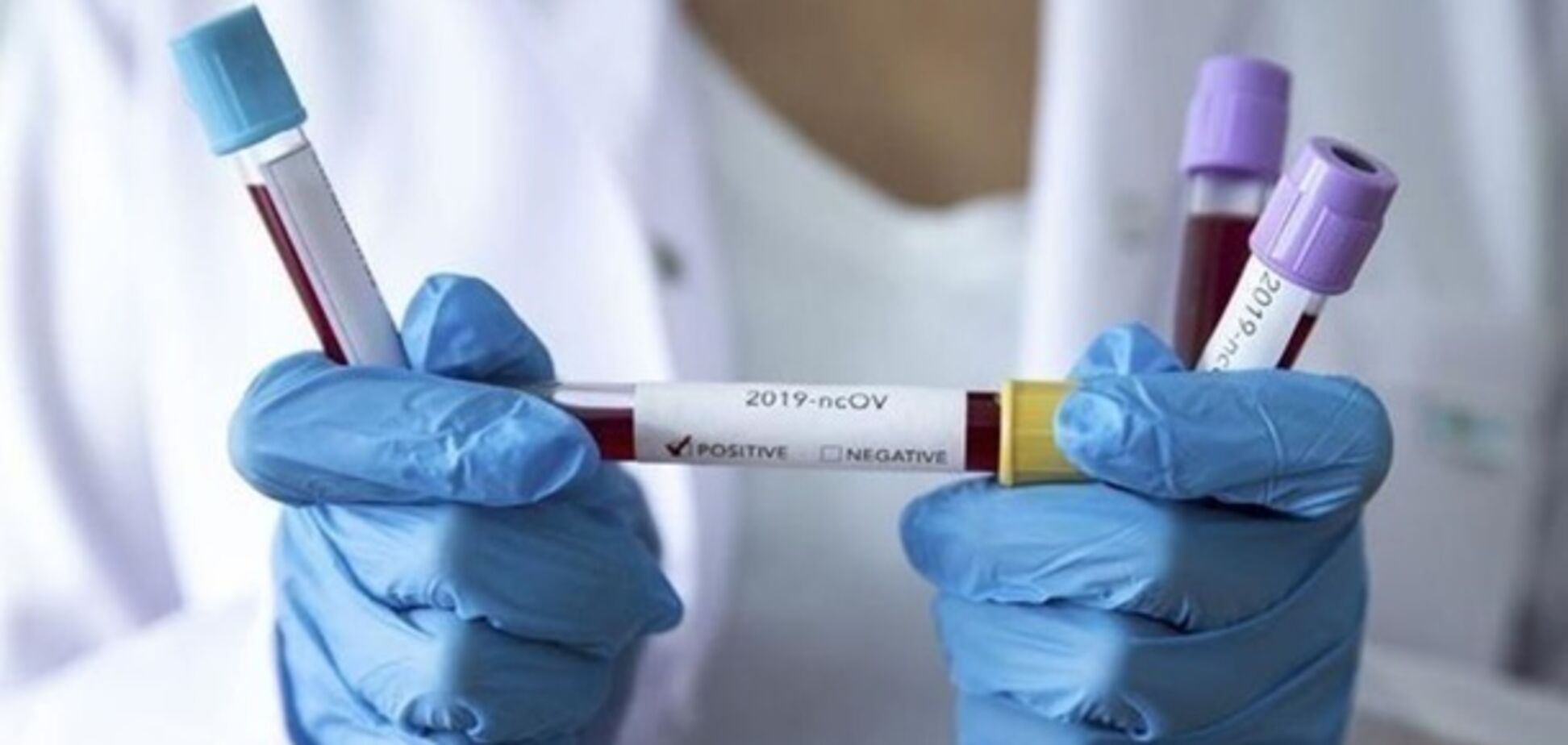 На Буковине зафиксировали почти тысячу случаев коронавируса