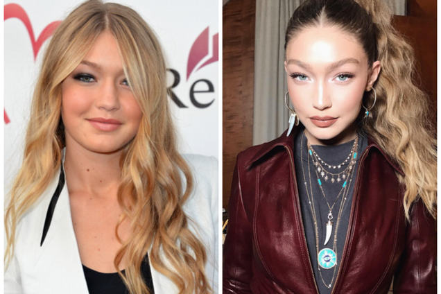 джиджи хадид до пластики