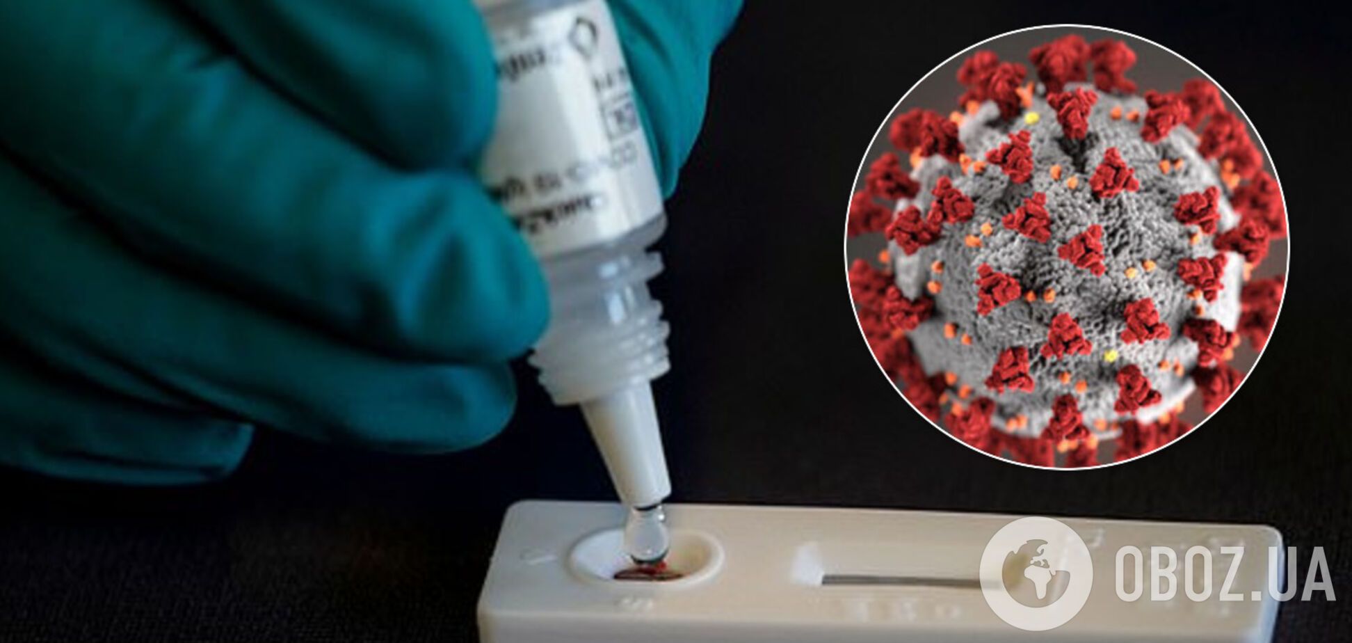 Точність 100%: у Бельгії розробили нові тести на COVID-19