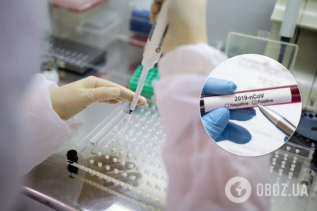 Два тести можуть врятувати світ від коронавірусу: як вони працюють