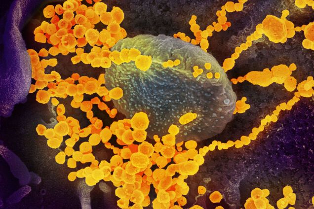 Названы самые уязвимые для коронавируса клетки в организме человека
