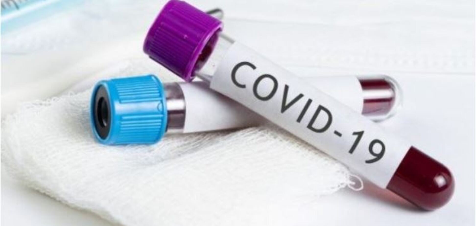 Серед лідерів із коронавірусу в Україні нова область