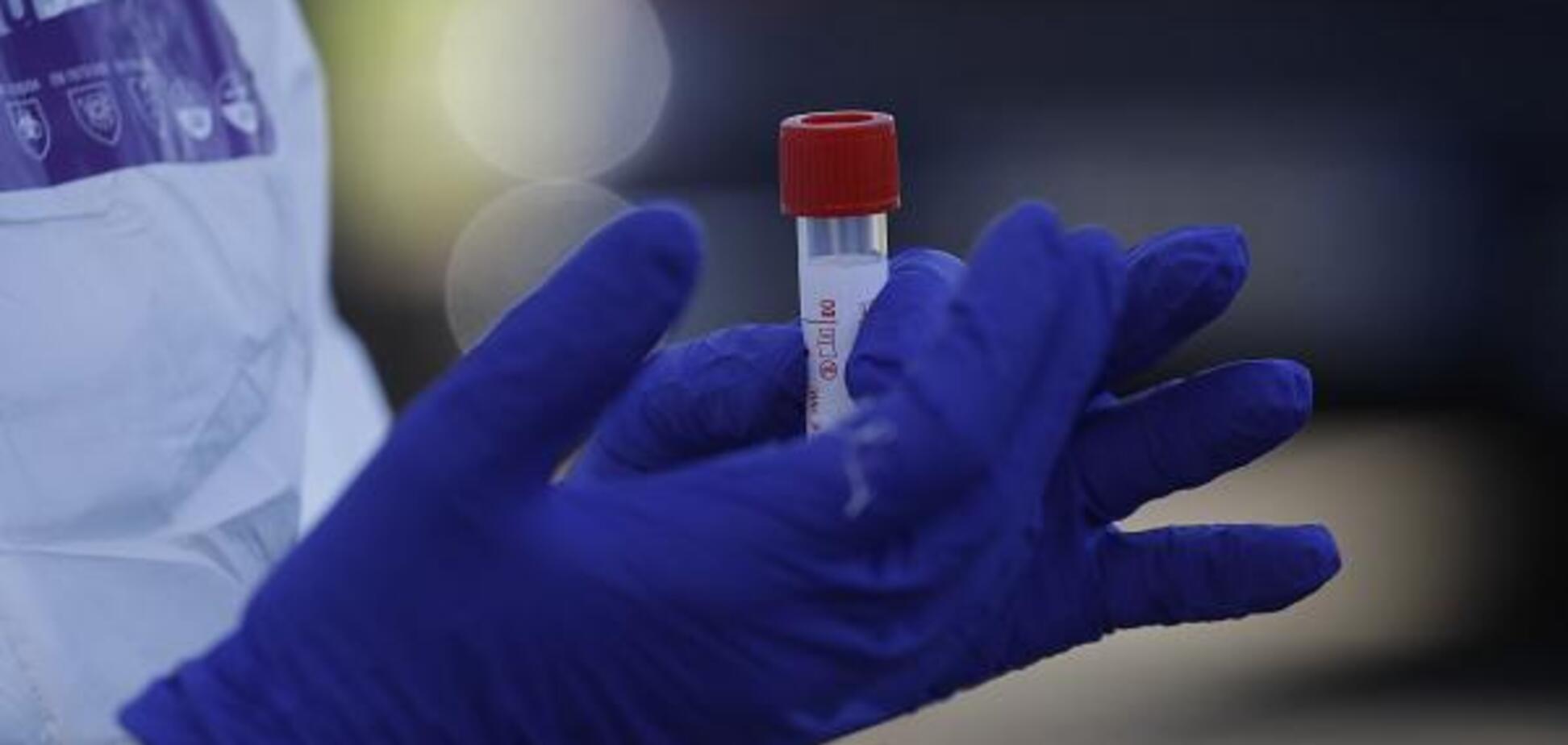 На Днепропетровщине подтвердили 8 новых случаев заболевания коронавирусом