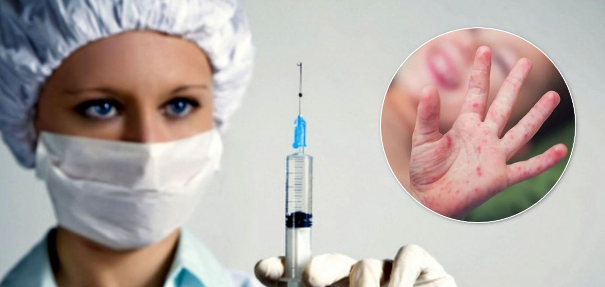 В Украине могут вспыхнуть три смертельные инфекции: медики забили тревогу