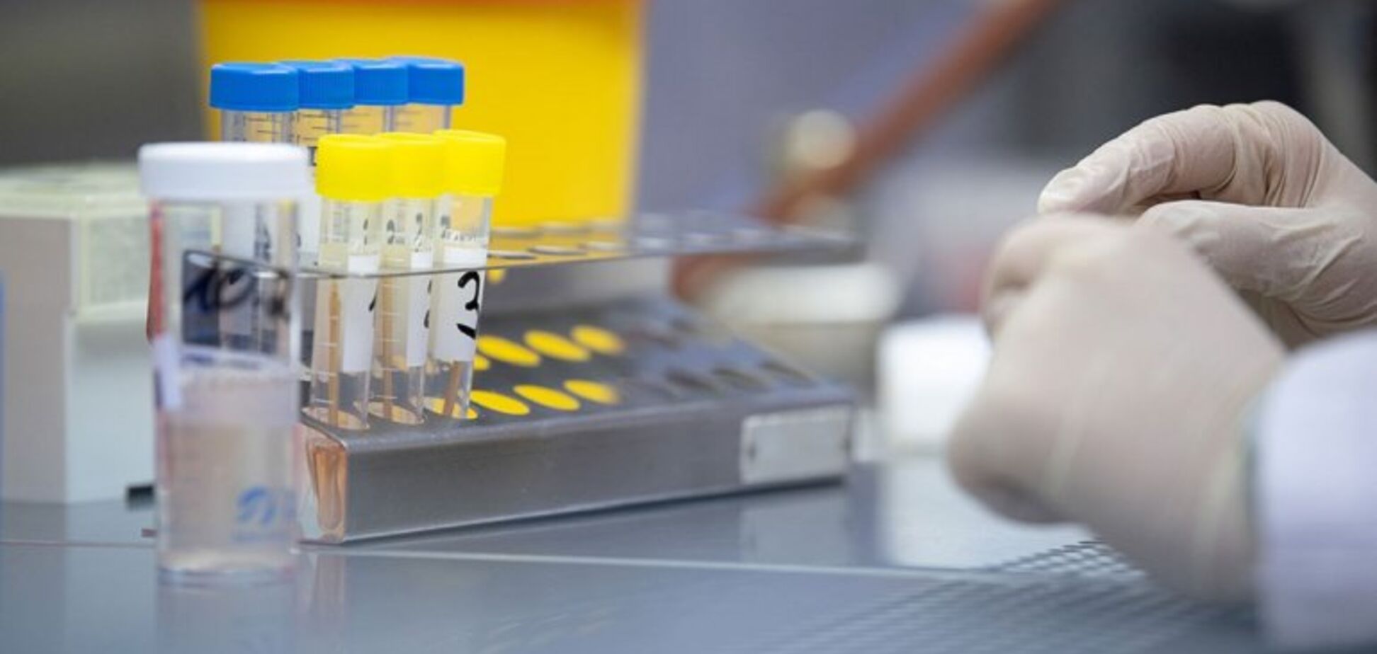 На Дніпропетровщині збільшилась кількість заражених COVID-19