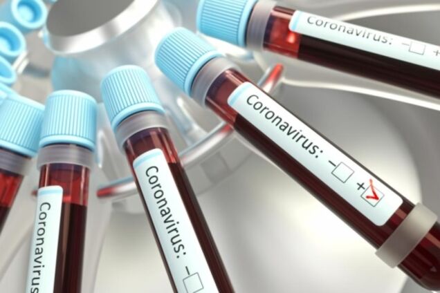 Коронавірус в Дніпрі підозрюють ще у 9 осіб: свіжа статистика