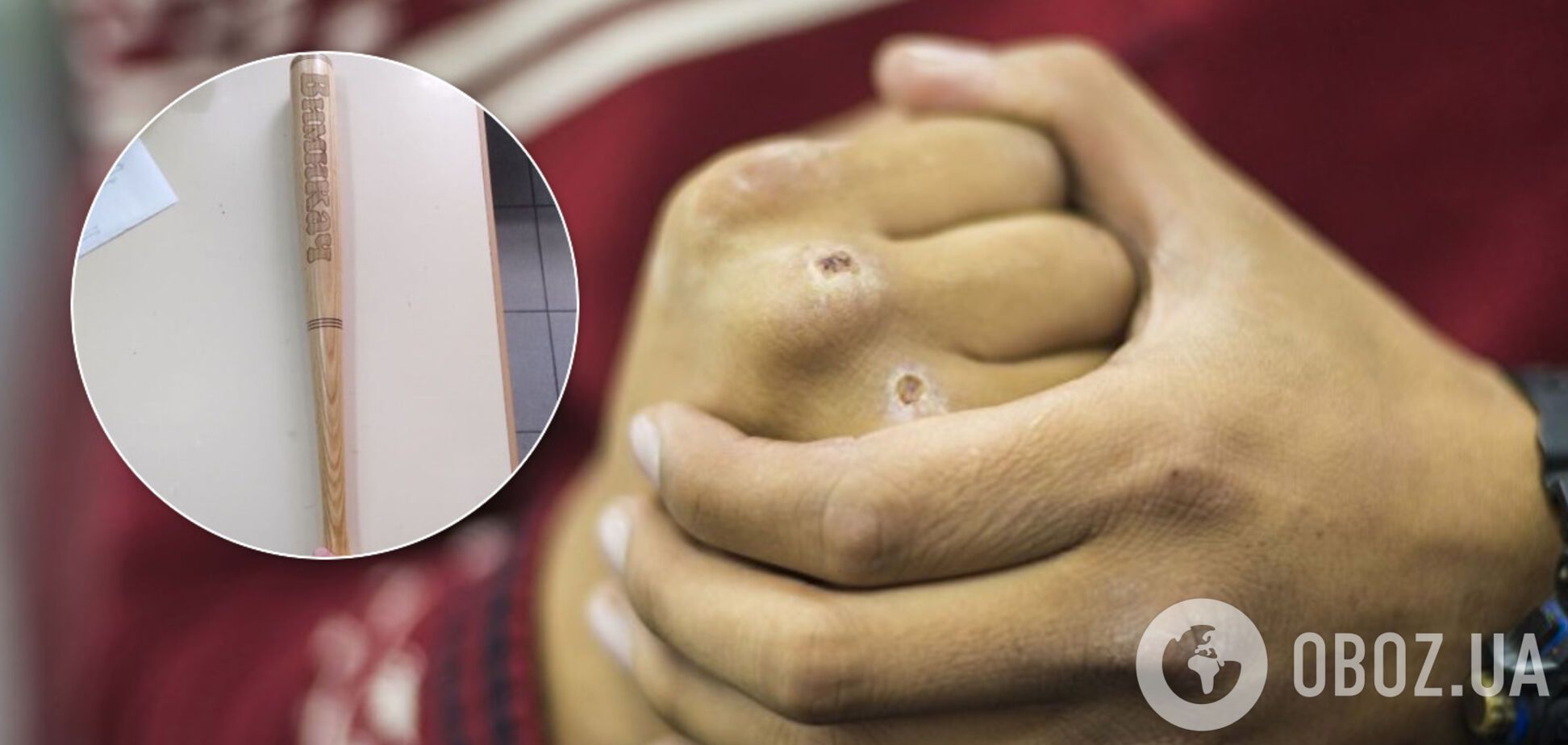 Били битами: во Львове произошла массовая драка студентов-иностранцев. Видео