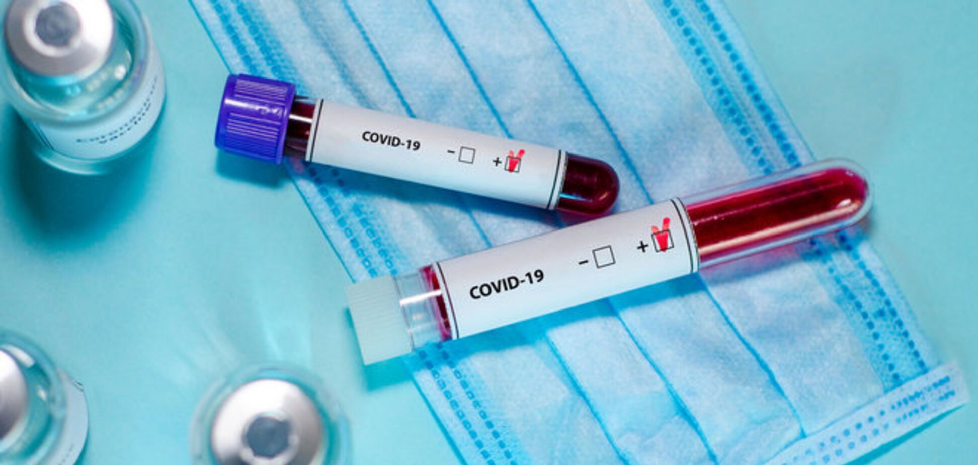 Для виявлення коронавірусу замовили 2 млн українських ПЛР-тестів