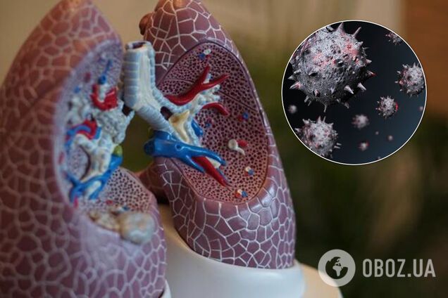 Коронавірус може залишатися глибоко в легенях після лікування: вчені зробили тривожне відкриття