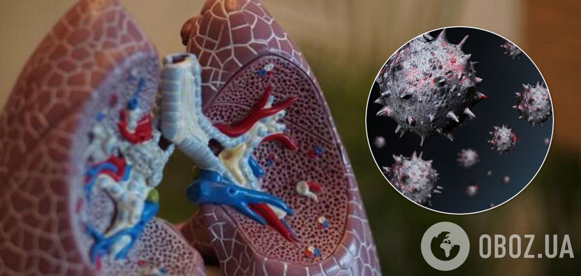 Коронавірус може залишатися глибоко в легенях після лікування: вчені зробили тривожне відкриття