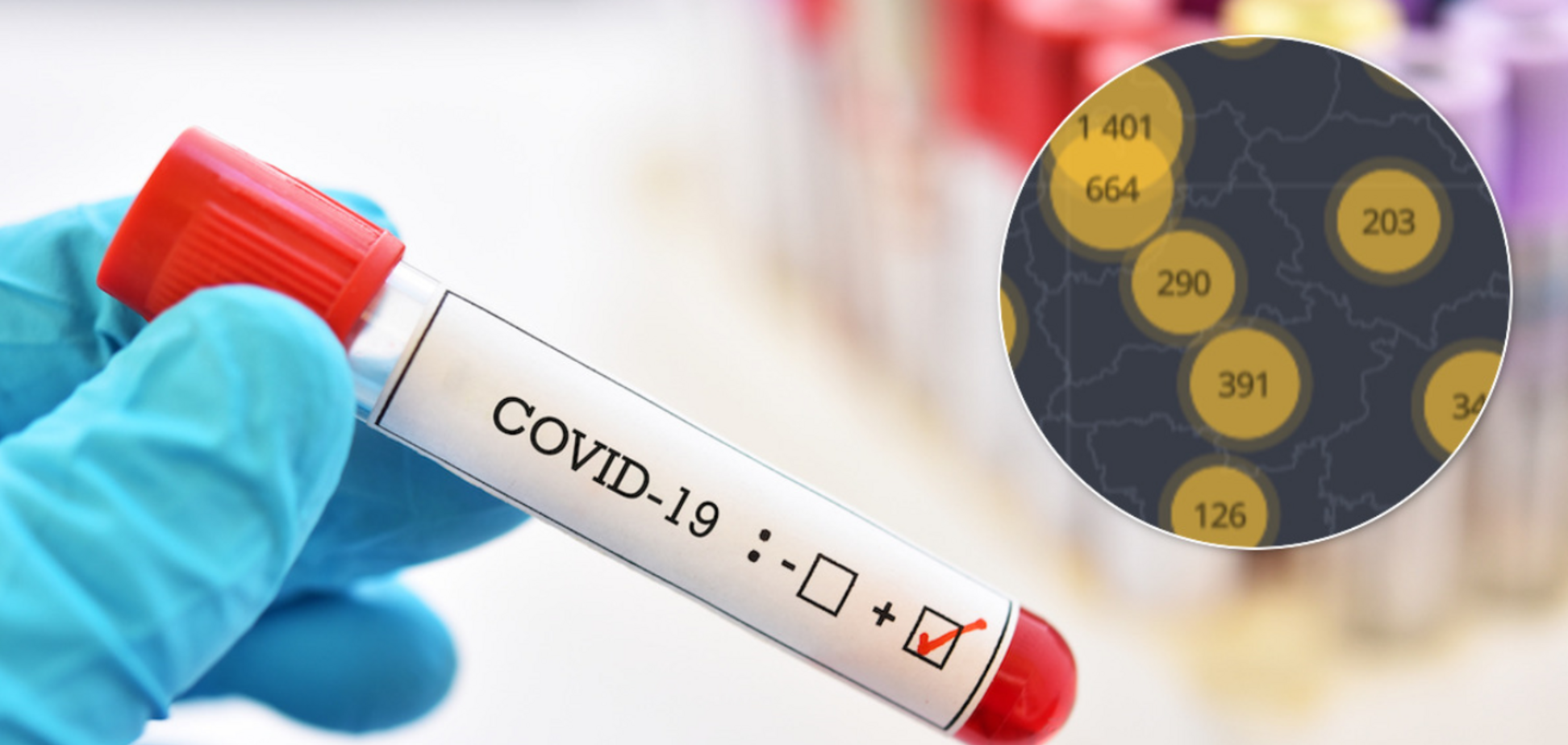 Коронавірус в Україні перетнув позначку в 10 тисяч хворих: статистика МОЗ