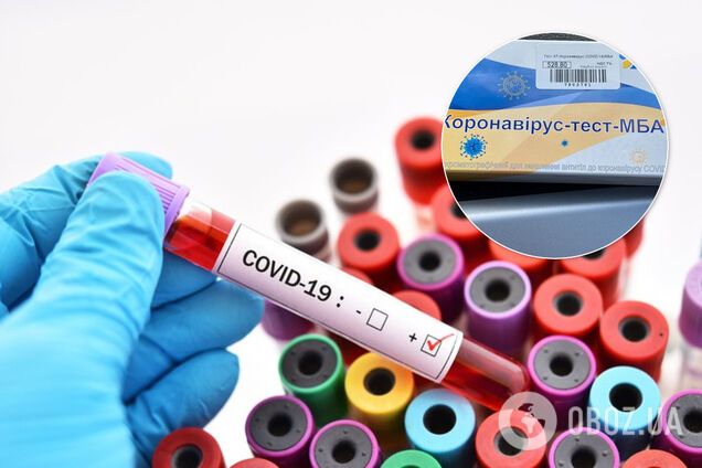 Медики озвучили тревожный нюанс тестов на коронавирус