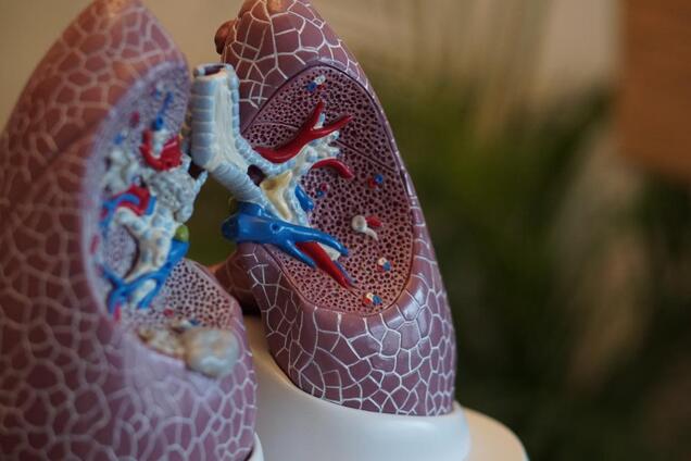 Коронавірус перетворює легені на ''гуму'': лікарка описала процес