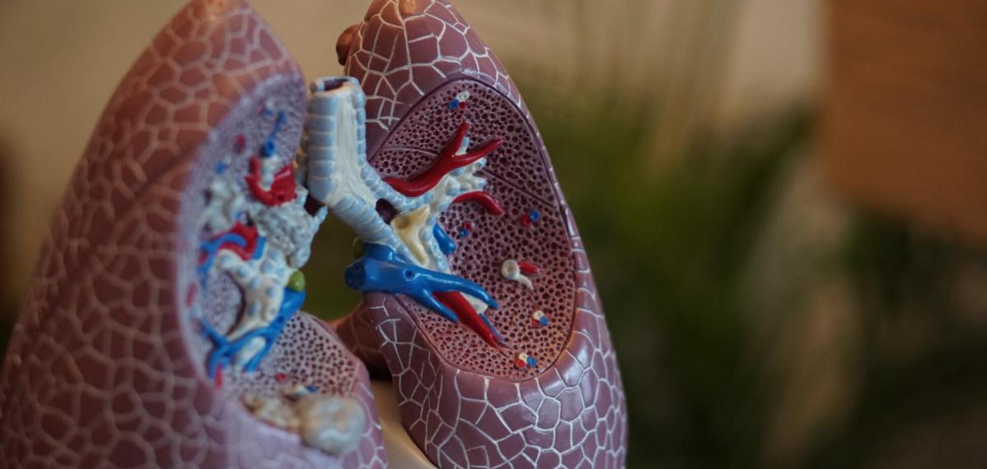 Коронавірус перетворює легені на 'гуму': лікарка описала процес