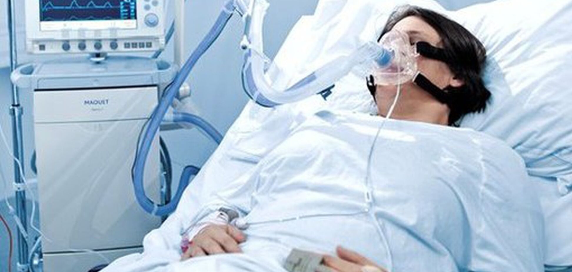 Лікар з Італії розкрив подробиці лікування коронавірусу, які вразили мережу