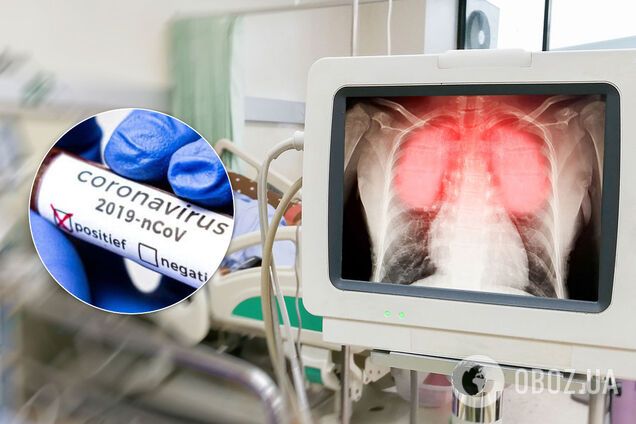 Заразив усю сім'ю: з'ясувалися моторошні подробиці смерті чоловіка з COVID-19 на Івано-Франківщині